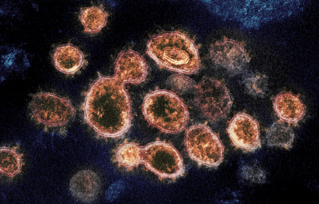 코로나19 전자현미경 사진./미 NIH 국립 알레르기 감염병 연구소 제공