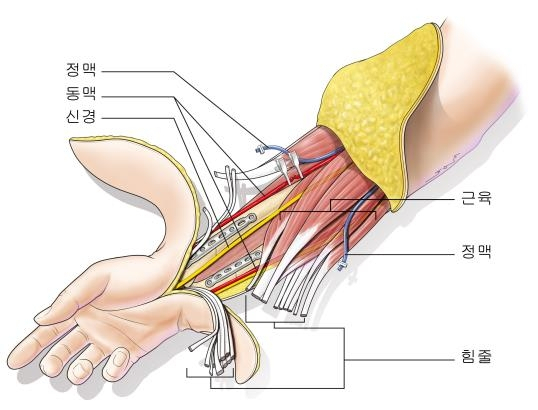 수부 이식/연합뉴스=세브란스병원 및 장동수, studioMID 제공