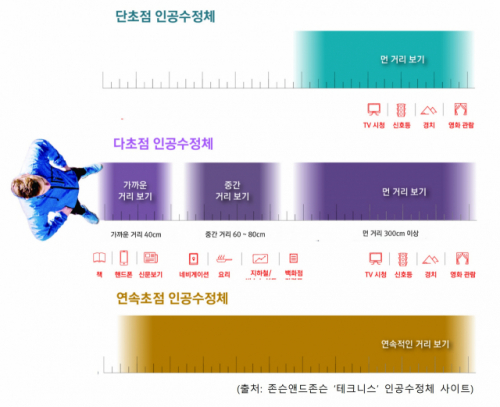 늘어나는 백내장 수술…나에게 맞는 인공수정체는?