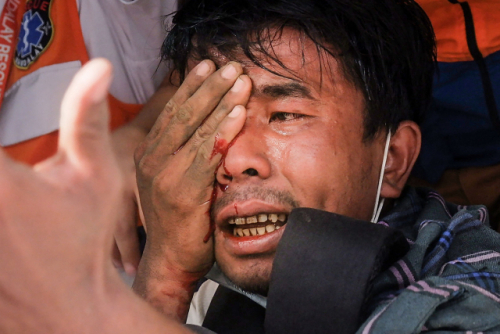 20일 미얀마 만델레이의 한 조선소에서 벌어진 시위를 진압하던 군경에 부상 당한 시위 참가자가 응급 처치를 받고 있다. /AFP 연합뉴스