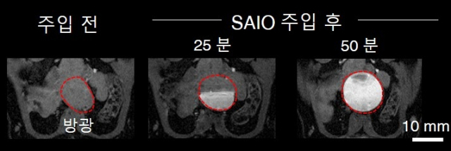 쥐의 뇌 MRI 촬영을 위해 투여한 SAIO 조영제는 시간이 지남에 따라 방광으로 모였다가 소변으로 배출된다.