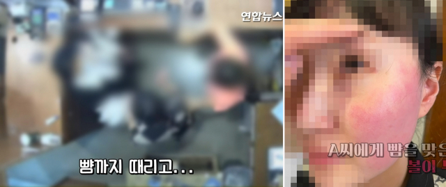 폭행 혐의로 경찰 조사를 받고 있는 주한 벨기에 대사 부인에게 뺨을 맞은 피해자인 옷가게 점원과 가족이 볼이 부은 사진과 폭행 당시 CCTV 영상을 20일 공개했다. /연합뉴스TV