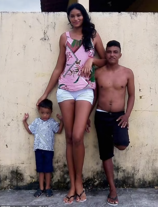 [영상]남편과의 키 차이 40cm…브라질女 2m 장신의 비밀은