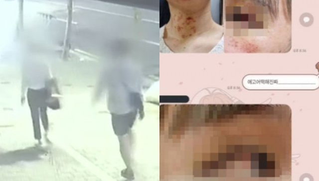 가해자가 피해자를 뒤쫓는 모습이 담긴 CCTV 화면(왼쪽)과 피해자 친구가 올린 피해자의 상태. /JTBC·트위터 캡처