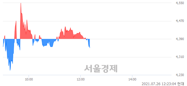 <코>인트로메딕, 매도잔량 406% 급증