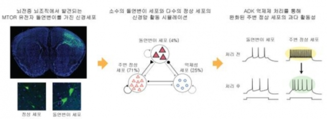 KAIST, 난치성 뇌전증(간질) 발병 과정 규명