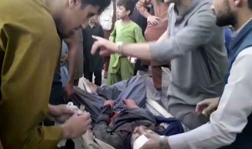 카불공항 폭탄테러로 부상을 입은 환자. /AP연합뉴스