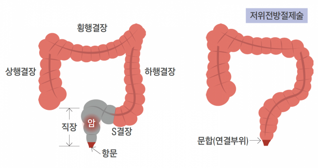 사진 제공=삼성서울병원