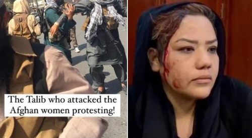 여성 시위대에 폭력 행사하는 탈레반과 해산 과정에서 머리를 다친 여성의 모습. /트위터 캡처
