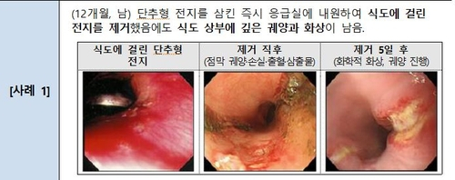 /연합뉴스=한국소비자원 제공