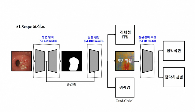 연구팀은 합성곱 신경망 기반 인공지능 모델을 개발하고 검증했다./사진 제공=서울대병원