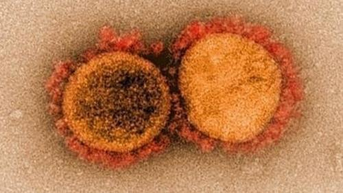 코로나19 바이러스 현미경 사진. /사진제공=미국 국립 알레르기 감염병 연구소(NIAID).