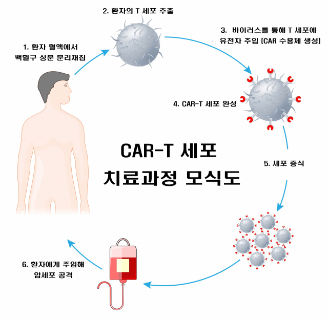 CAR-T 세포 치료과정 모식도. CAR-T는 환자에게서 체내 면역을 담당하는 T세포를 추출한 다음 항체의 바이러스 벡터를 활용해 암세포에 특이적인 키메릭 항원 수용체(CAR)를 발현시키고 재주입하는 새로운 방식의 항암제다./사진 제공=서울대병원