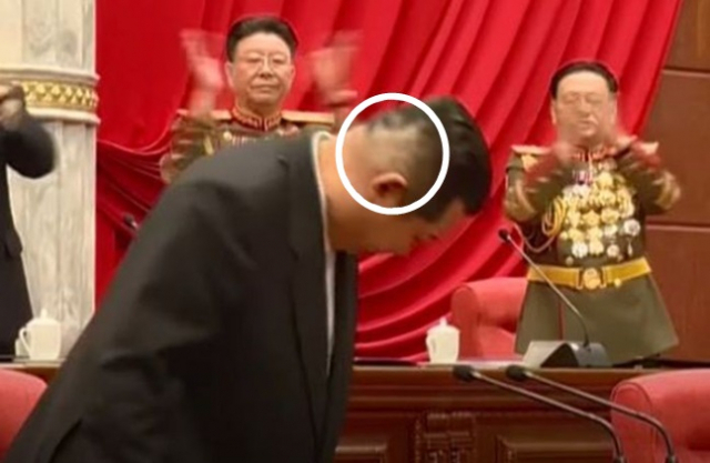 지난주 8기 4차 전원회의를 주재한 김정은 북한 국무위원장의 오른쪽 뒤통수에 의료용 테이프를 붙였다 뗀 자국(가운데 흰색 원)이 보인다./사진=조선중앙TV 방송화면 캡처
