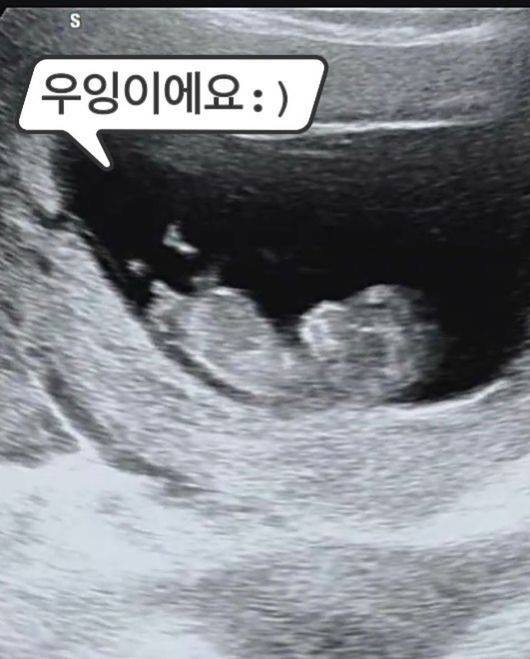 이필모♥서수연, 둘째 임신 '8월 출산 예정'→홍현희·이하정 축하
