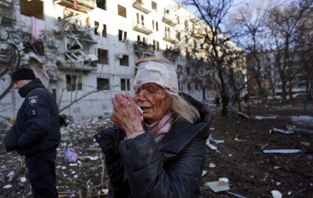24일 러시아군의 폭격을 맞은 우크라이나 동부 도시 추위브의 한 아파트 앞에서 머리를 붕대로 감싼 여성이 피 묻은 얼굴로 눈을 감고 있다. 트위터에 올라온 이 사진에는 '푸틴, 당신이 이 여성의 상처에 책임이 있다'고 적혀 있다. 트위터 캡처