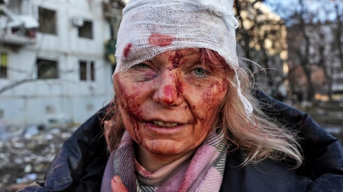 한 우크라이나 여성이 러시아 미사일 공격에서 생존한 뒤 피를 흘리고 있는 모습이 포착됐다./연합뉴스