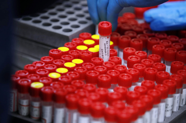 전국 일일 코로나19 신규 확진자가 40만 명을 넘어선 16일 오후 광주 북구 상시 선별진료소에서 보건소 의료진이 이날 채취해 검사 의뢰할 검체의 수량을 확인하고 있다. 연합뉴스
