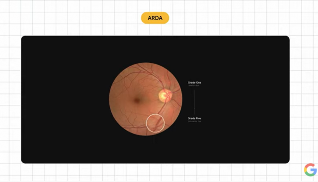 구글헬스가 개발 중인 당뇨 관련 안구 질환 포착하는 AI 머신러닝 ‘아르다(ARDA)’ 기술 /사진 제공=기술