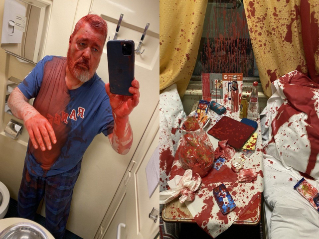 러시아 독립언론 ‘노바야 가제타’의 편집장인 드미트리 무라토프가 붉은 페인트로 공격받은 모습(왼쪽)과 붉게 얼룩진 열차의 침대칸. 트위터 캡처