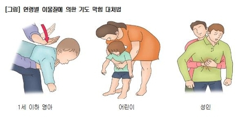 사진 제공=서울아산병원