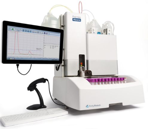 트리니티 바이오테크의 당화혈색소 진단 장비. 사진제공=미코바이오메드