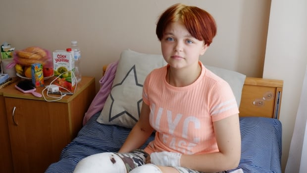 우크라이나의 15세 소녀 리사 체르니센코가 러시아군의 포격으로 다리에 부상을 입은 채로 약 32km를 운전해 민간인 4명을 구했다. 트위터 캡처