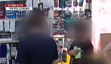 대전의 한 슈퍼마켓 사장이 가게에서 물건을 훔치던 9살 아이의 몸에서 아동학대의 흔적을 발견하고 경찰에 신고했다. YTN 뉴스 캡처