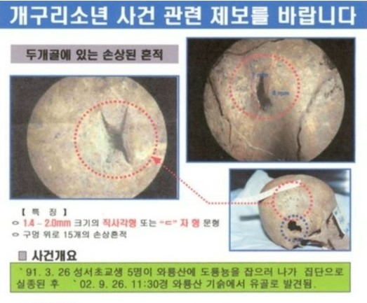 개구리소년 사건 피해 어린이 두개골 사진. 대구 달서경찰서 제공