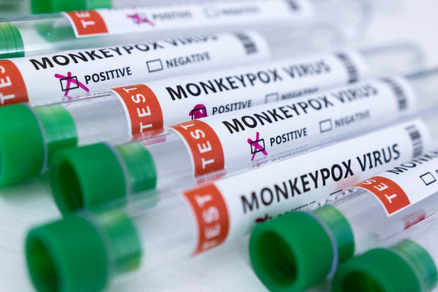 원숭이두창 바이러스 시험 튜브의 모습. 로이터연합뉴스