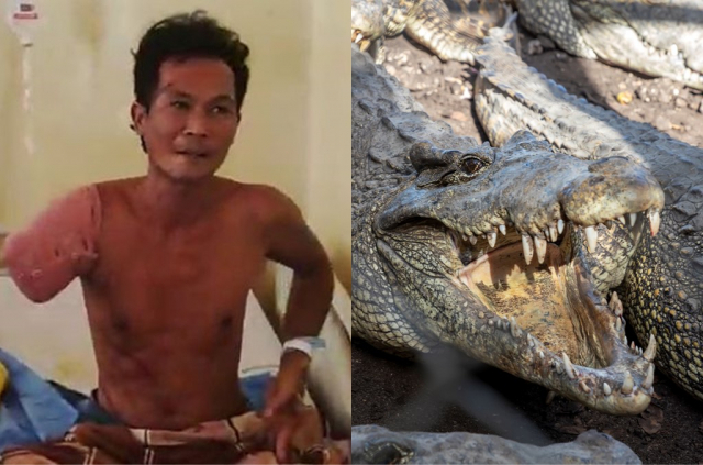 지난 9일(현지시간) 인도네시아의 한 동물원에서 손을 씻으려고 연못에 손을 넣은 일함(왼쪽)이 악어에게 한쪽 팔을 잃는 사건이 발생했다. 데일리스타 캡처·이미지투데이