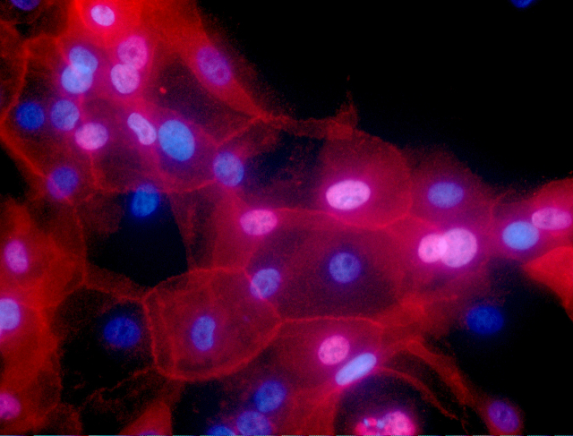 미국 NIH(National Institutes of Health)가 2016년 인간 유방암 세포를 배양해 만든 이미지. /AP연합뉴스