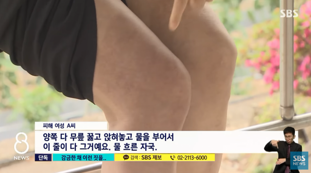 성매매업주 A씨는 피해 여성에게 끓는 물을 붓는 등의 가혹 행위를 한 것으로 알려졌다. SBS캡처