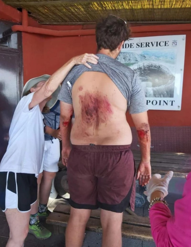 지난 9일 한 미국 남성(23)이 베수비오 화산 분화구에서 셀카를 찍다 추락해 부상을 입었다. NBC news 캡처