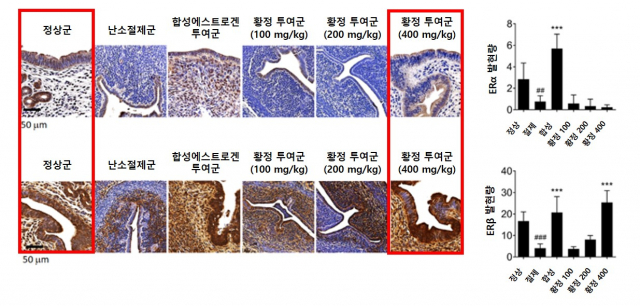 황정 투여군의 경우 자궁내막에서 ERα는 억제하고 ERβ의 발현만 증가시켜 정상군과 근접한 치료 효과를 보이는 동시에 자궁내막 과형성 억제 효과를 보였다. 사진 제공=자생한방병원