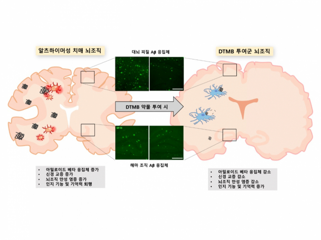 당뇨병 치료제로 치매 잡는 길 열렸다