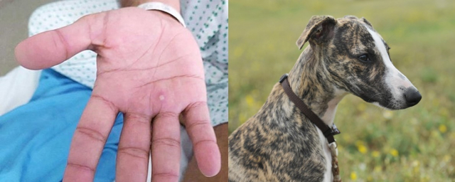 원숭이두창 감염자의 손에 나타난 증상(왼쪽)과 그레이 하운드(오른쪽). 연합뉴스·이미지투데이