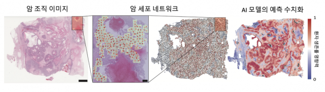 암 조직 네트워크화와 그래프 딥러닝 결과. 서울대 제공