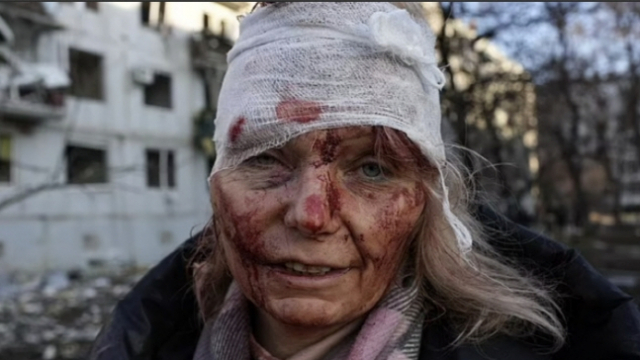 러시아 미사일 공격에서 생존한 우크라이나 교사 올레나 쿠릴로. 연합뉴스