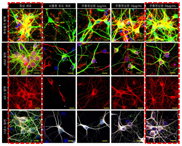 우황청심원 농도별 축삭돌기와 VEGF, IGF-1, 시냅스 발현량 비교. 농도가 높을수록 모든 지표에서 발현이 증가했다. 사진 제공=자생한방병원