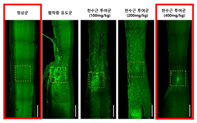 실리콘 이식 부위에 집중됐던 염증성 대식세포가 천수근에 농도 의존적으로 감소했다. 사진 제공=자생한방병원