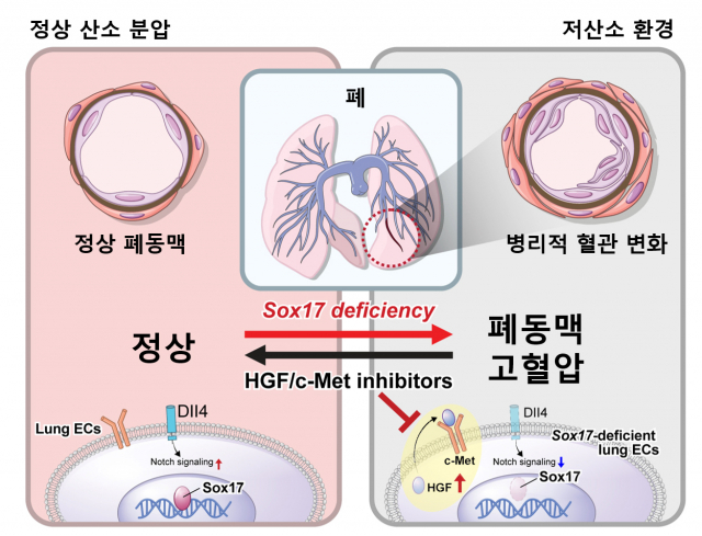 Sox17 유전자가 결핍되고 저산소 환경에 노출되면 폐동맥 고혈압 발생 위험이 높아지는 것으로 나타났다. 사진 제공=서울대병원