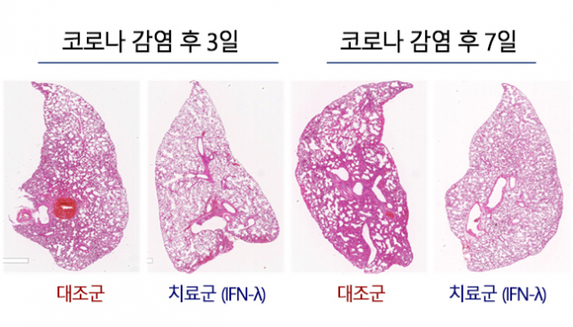 인터페론 람다를 투여한 동물모델의 폐 조직분석 결과. 사진 제공=서울대병원