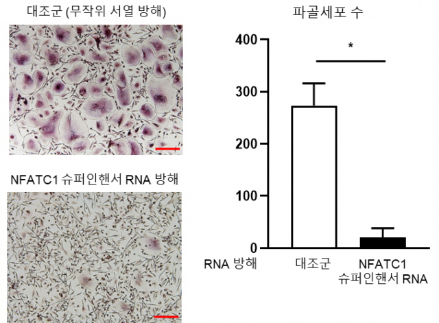 NFATC1 슈퍼인핸서 RNA의 억제가 파골세포 형성 과정에 미치는 영향. 그림=유니스트