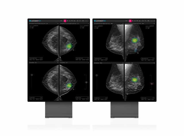 루닛, 3D 유방암 검진 AI 솔루션 '루닛 인사이트 DBT' 수출허가