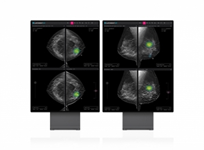 루닛, 3D 유방암 검진 AI 솔루션 '루닛 인사이트 DBT' 수출허가