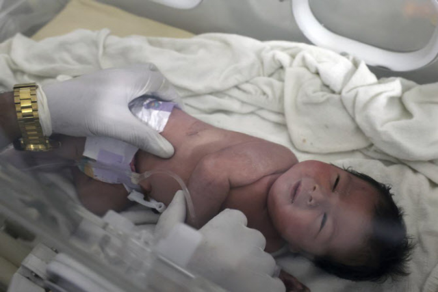 지진 피해 현장에서 구조된 아기. AP연합뉴스