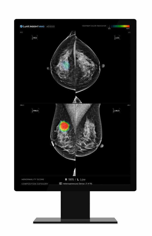 유방촬영술 AI 영상분석 솔루션 '루닛 인사이트 MMG' 작동 이미지. 사진 제공=루닛