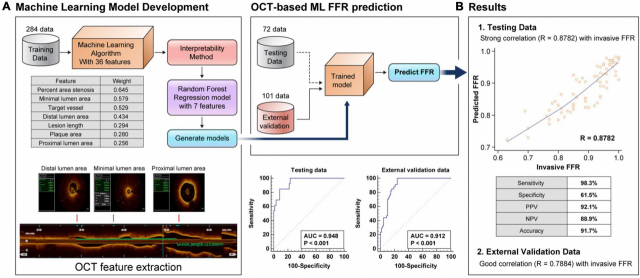 OCT 기반 머신러닝 도출 방법(A)을 통해 예측한 FFR 값과 실제 측정한 FFR 값의 상관관계(B). 머신러닝을 통한 예측과 실제 측정값의 상관관계가 0.8782(C)로 실제 측정값과 유사했고, 분석의 민감도와 정확도는 각각 98.3%, 91.7%로 나타났다. 사진 제공=세브란스병원