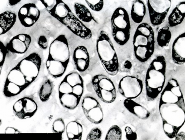 합성생물학으로 개발한 대장균이 생분해성 플라스틱으로 변하는 모습을 전자현미경으로 찍은 모습. 사진 제공=이상엽 KAIST 연구부총장